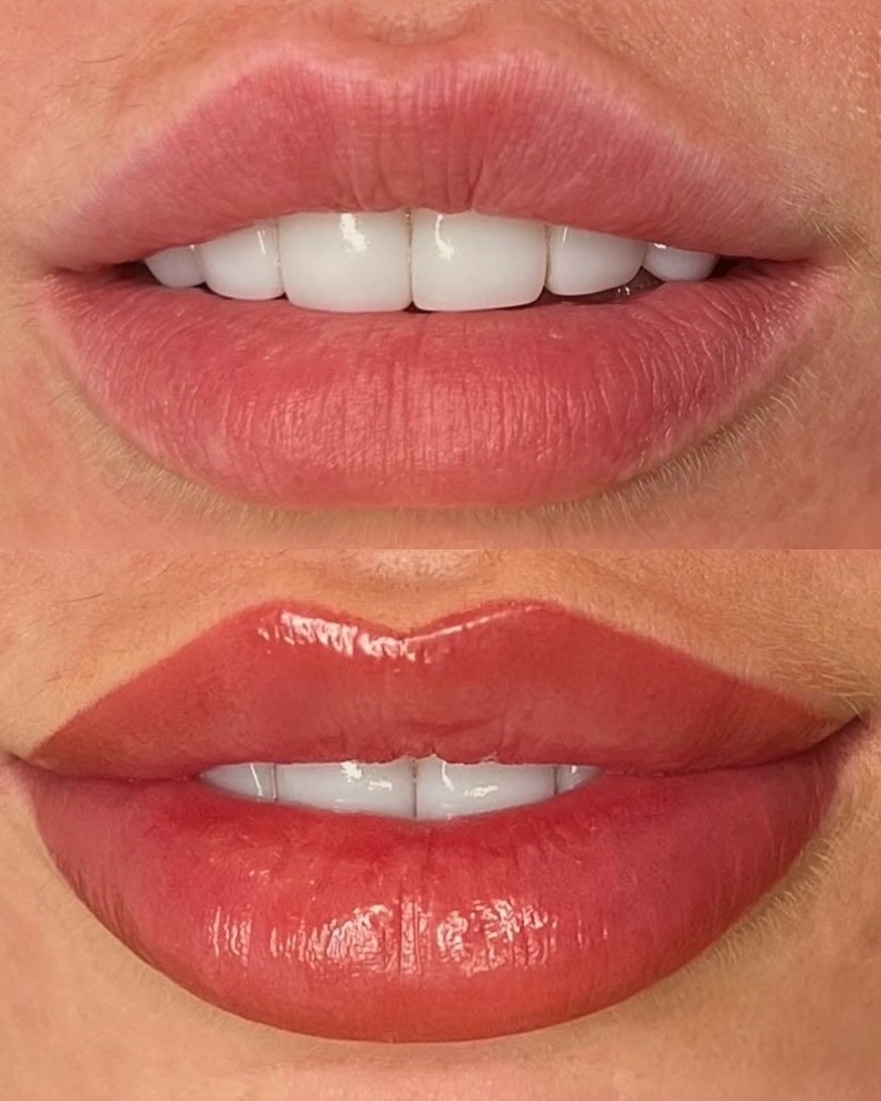 lip blush